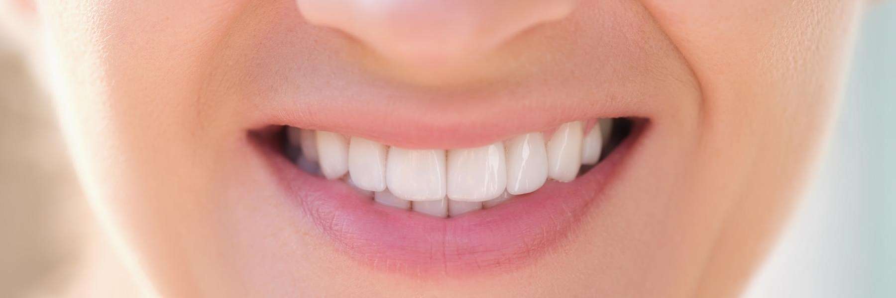 close up of patient's smile | dental clinic lara