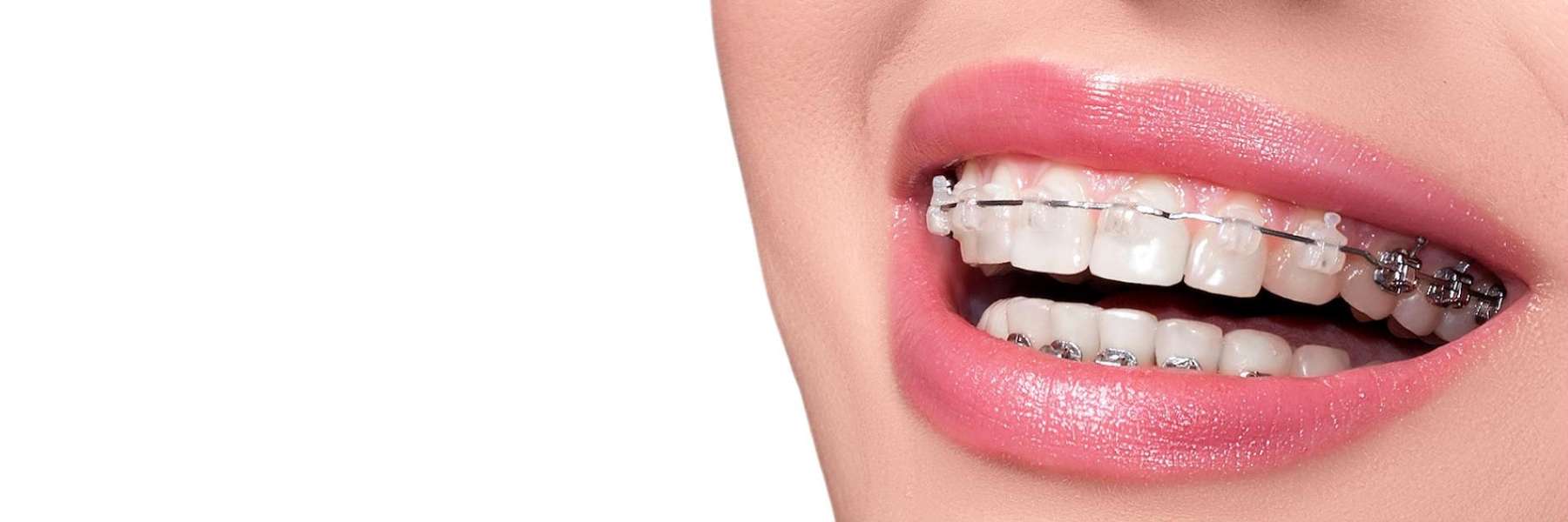 Orthodontics | Dentist